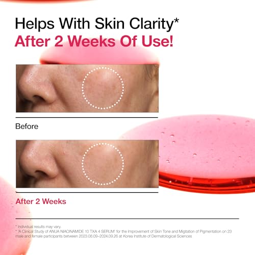 ANUA 10% Niacinamide+ 4% Tranexamic Acid Serum, Ceramide, Hyaluronic Acid, Vitamin B12 Natural color, Korean Glass Skin, Fragrance-Free, Korean Skincare, 30ml /1.01 fl.oz.