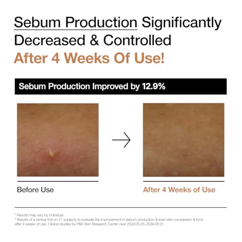 ANUA Rice 70 Glow Milky Toner, for Glass Skin, Rice Water, Niacinamide, Ceramides, Panthenol, Non comedogenic, Fungal Acne Safe, Korean Skin Care, 250ml/8.45fl.oz.