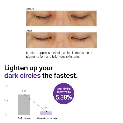 Some By Mi Retinol Intense Advanced Triple Action Eye Cream | 30ml | Mild Overnight Korean Anti-Aging Eye Cream | for Dark Circles & Fine Lines | Ideal for Retinol Beginners