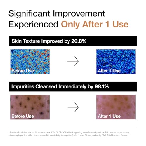 ANUA Rice Enzyme Brightening Cleansing Powder, Rice Mask, Ceramide, Gentle Face Wash for Brightening, Radiant Skin, Facial Cleanser for Dry Skin, Korean Skincare, Fragrance Free, 40g/1.41fl.oz.