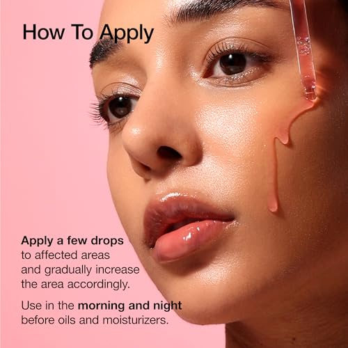 ANUA 10% Niacinamide+ 4% Tranexamic Acid Serum, Ceramide, Hyaluronic Acid, Vitamin B12 Natural color, Korean Glass Skin, Fragrance-Free, Korean Skincare, 30ml /1.01 fl.oz.