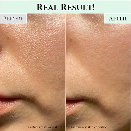 Beauty of Joseon Green Plum Refreshing Cleanser Gel Type Deep Pore Cleansing, Acne Face Wash, Blackhead Remover for All Skin Types, Korean Skincare 100ml, 3.38 fl.oz