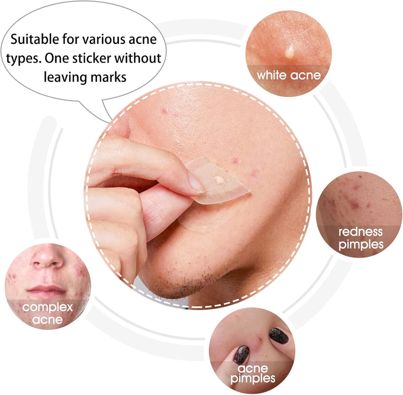 Hydrocolloid Acne Patch(20 Patches), Large Spot Control Cover With Long Size, Extra Larger Acne Pimple Patch for Covering Large Breakouts, Spot Patch, Stickers for Body, Cheek, Forehead, and Chin