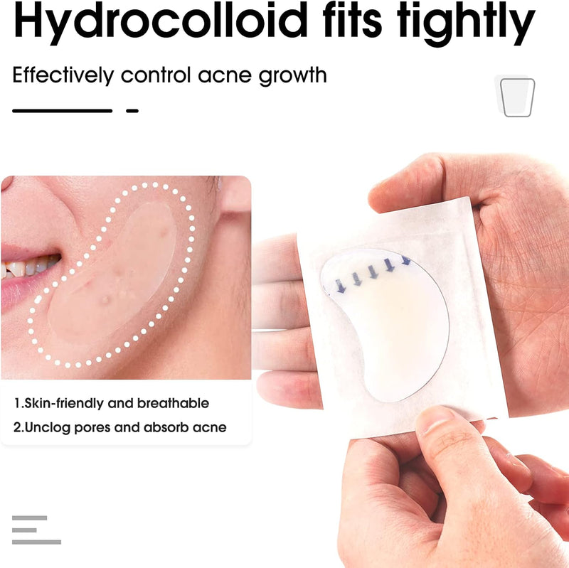 Hydrocolloid Acne Patch(20 Patches), Large Spot Control Cover With Long Size, Extra Larger Acne Pimple Patch for Covering Large Breakouts, Spot Patch, Stickers for Body, Cheek, Forehead, and Chin