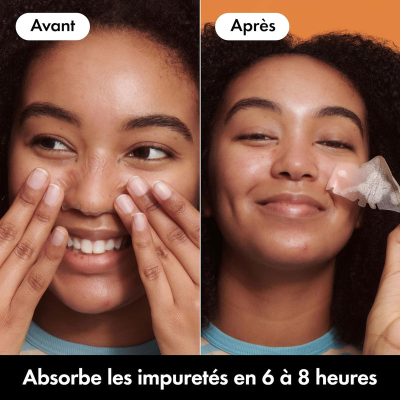 Hero - Mighty Patch Nose - Special Nose - Absorbs impurities from pores and pimples in 6 to 8 hours - Hydrocolloids - Box of 10 Mighty Patches Nose