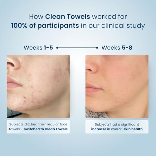 CLEAN SKIN CLUB CSC CT Clean Towels XL/World's First Biodegradable Face Towel/Disposable Makeup Removal Wipes/Super Soft 50 Count Single BoxWhite