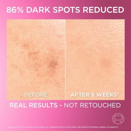 L’Oréal Paris Melasyl Glycolic Acid and Anti Dark Spot Face Serum with Niacinamide, Instant Glow 30 ml