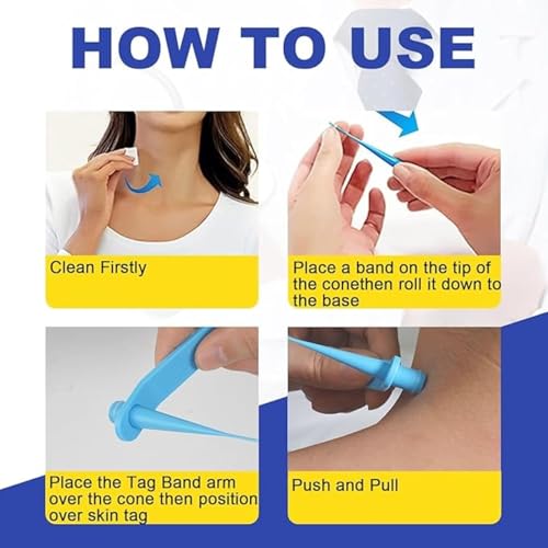 ALMEKAQUZ Home Wart Removal Tool Set for Face and Body,Professional blackhead and acne tool for women and men, Quick and painless blemish cleansing with easy to grip handles, Skincare accessory tha