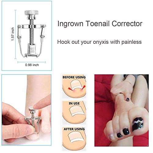 MAKINGTEC 10Pcs/Set Ingrown Toenail Tools Kit, Nail Treatment Foot Tool,Ingrown Toenail Removal Correction Clippers, Surgery Grade Nail File Lifter, Professional Pedicure Tool whit Storage Package