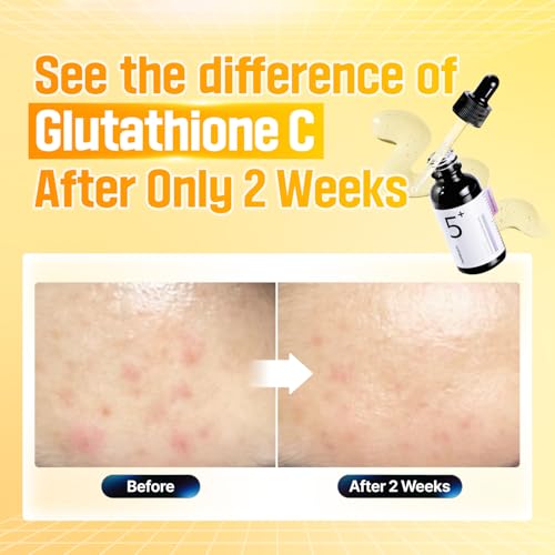 numbuzin No.5 Serum | Glutathione Vitamin Concentrated Serum | Glutathione, Vitamin C, Tranexamic Acid | Hyperpigmentation, Acne Scars | Suitable for Sensitive Skin, Korean Skincare | 1.01 fl. oz.