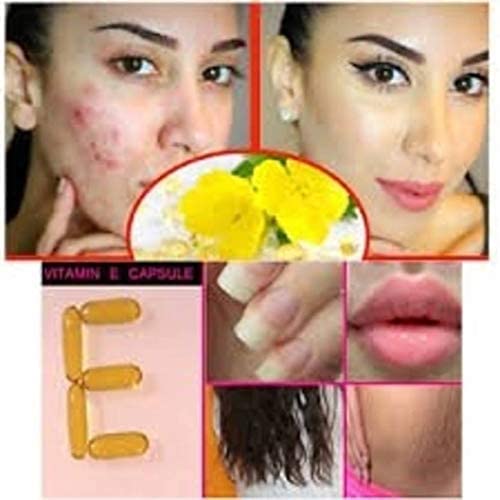 Best Choice Nutrition Vitamin E, 50 capsules |for beautiful skin, healthy hair and eyes