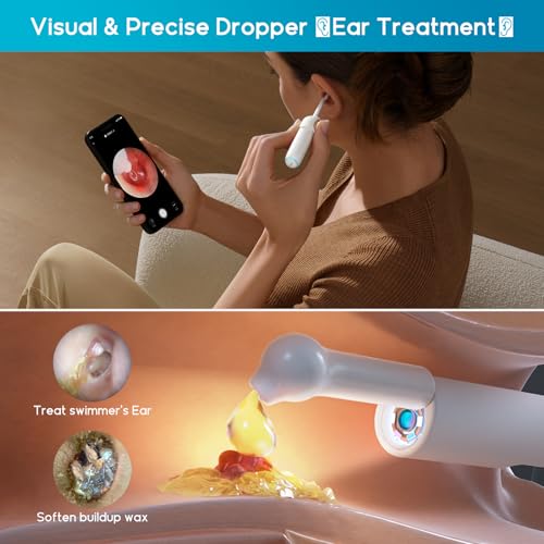 BEBIRD Home 30S Ear Care System - Ear Canal Cleaner with Flexible Scope FHD Camera, UVC LED Light, Visual Ear-Drops Dropper, Wax Removal Tweezers Tool to Clean Ear, 3 Set Cleaning Kits for Adult/Kids