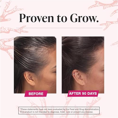 Viviscal Hair growth supplement for women, 60 Count, 1 Month Supply