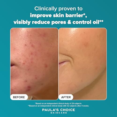 Paula's Choice SKIN PERFECTING 2% BHA Liquid Exfoliant - Face Exfoliating Peel Fights Blackheads & Enlarged Pores - with Salicylic Acid - Combination & Oily Skin - 30 ml