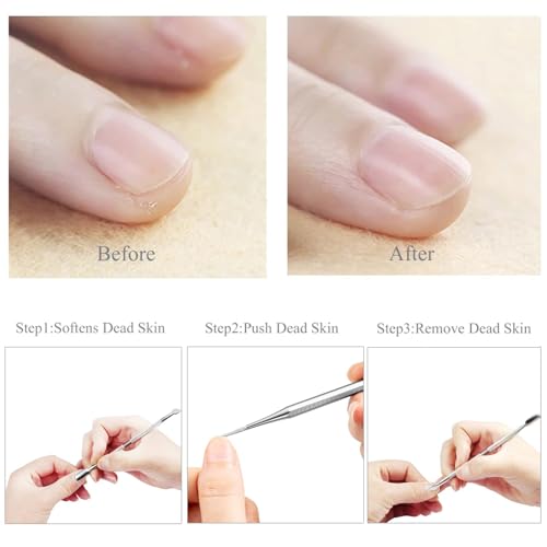 Insert and Nail File Pedicure Tool Set Stainless Steel Insert Toenail File Nail File Foot Care Stainless Steel Manicure and Pedicure Set 6 Pieces (With Storage Box)