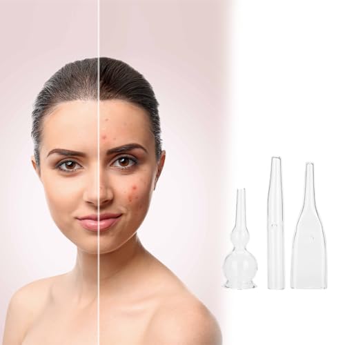 Lwuey Vacuum Glass Tube, Blackhead Removal Glass Pipes Set Facial Cleansers Whitehead Removing Glass Pipe Kit Machine Accessories Device for Face Suction Pore Cleanser Beauty Equipment Home Salon 3PCS
