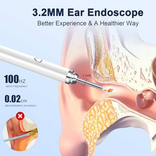 Coolfor Ear Wax Removal Kit，Ear Cleaner with Camera HD 1080P, Ear Wax Removal Tool Camera, Ear Scope Otoscope with 6 LED Lights,Earwax Removal Kit with 5 Ear Spoon for iOS & Android (White)