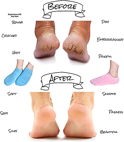 Moisturizing Socks, Gel Socks Soft Moisturizing Gel Socks, Gel Spa Socks for Repairing and Softening Dry Cracked Feet Skins, Gel Lining Infused with Essential Oils and Vitamins - Assorted Color