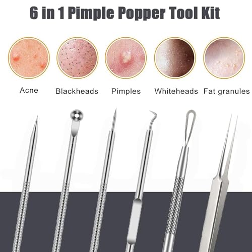 6 PCS Blackhead Remover Comedone Extractor Acne Needle Tools Set Professional Stainless Blackhead Tweezer Kit Removing Whitehead Popping Zit for Nose Face Skin Blemish Treatment Pimple Popper Tool Kit