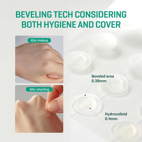 Some By Mi 30 Days Miracle Clear Spot Patch | 18 Counts, 2 Size(10mm 9Counts, 12mm 9Counts) | Invisible Hydrocolloid Skin Trouble & Pimple Patch with No Irritation | Pack of 1