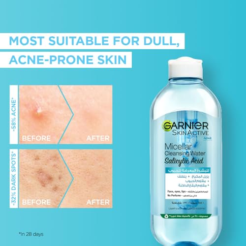 Garnier Skinactive Micellar Cleansing Water, For Acne Prone Skin, with Salicylic Acid, 400ml