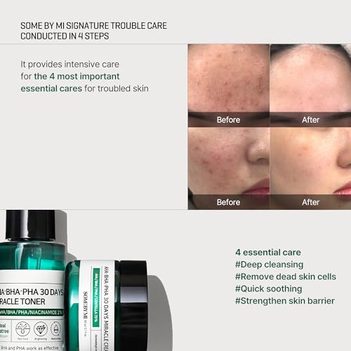 Some By Mi AHA-BHA-PHA 30 Days Miracle Starter Kit | Toner 30Ml + Serum 10Ml + Cream 20G + Cleansing Bar 30G | Set Of 4 Travel Kit