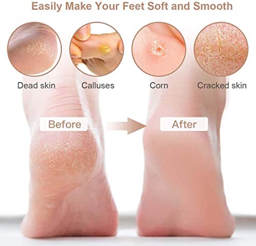 SYOSI 15Pcs Professional Pedicure Tools, Nail Toenail Clipper Nail File for Hard Skin Dead Skin, Foot Clean Care, Exfoliating Stainless Steel Pedicure Tools