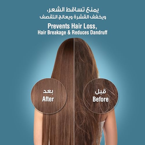 blu Ionic Shower Head and Shower Filter - Handheld - Removes Chlorine & Harmful Pollutants - Prevent Hair Loss & Moisturize Your Skin, Chrome