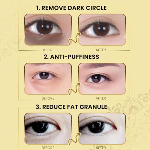 KANZA - 60 Pcs Supplement Collagen Eye Mask(30 Pairs)| Under Eye Patches for Eye Bags & Anti-Aging Treatment | Reduces Dark Circles,Puffiness,Wrinkles | Hydrogel Eye Patch | Under Eye Mask Set