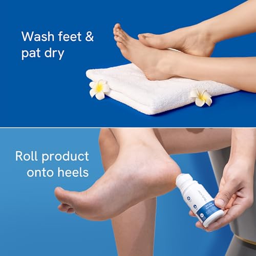 Be Bodywise 20% Urea Foot Cream Roll On | Repairs Dry & Cracked Heels | 2% Lactic Acid, Olive Oil & Vitamin E I Exfoliates & Softens Skin I Hydrates & Moisturises INo Irritation IAll Skin TypesI 50 ml