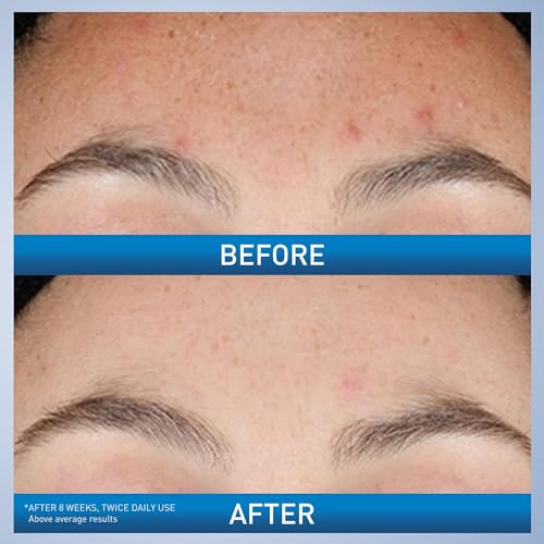 CERAVE RESURFACING RETINOL SERUM TO REDUCE THE APPEARANCE OF POST-ACNE MARKS AND PORES WITH RETINOL, LICORICE ROOT EXTRACT & NIACINAMIDE 30ML