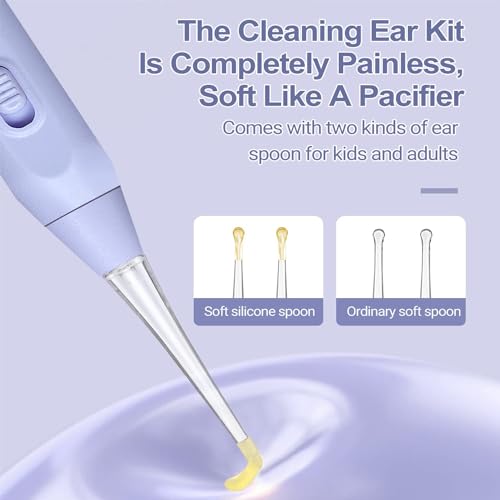 Joyzzz Ear Wax Removal Tool, Ear Cleaning Tool with USB Charging, Ear Wax Remover with Light Kids, Ear Cleaner with Built-in Storage Space, Upgraded Ear Wax Removal with Light for Kids & Adults