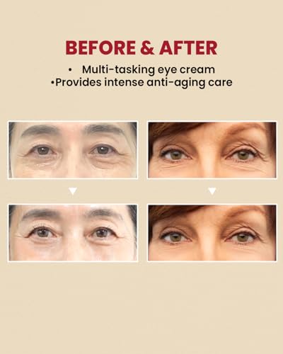 K-SECRET SEOUL 1988 Eye Cream : Retinal Liposome 4% + Fermented Bean