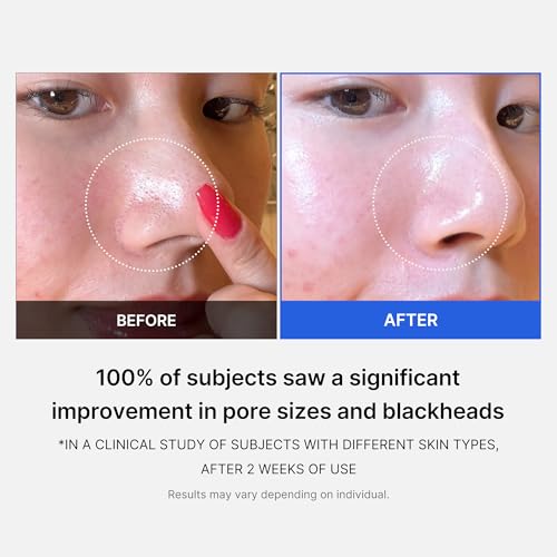 medicube Zero Pore Pads 2.0, Dual-Textured Facial Toner Pads for Exfoliation and Pore Care with 4.5% AHA Lactic Acid & 0.45% BHA Salicylic Acid, Ideal for All Skin Types, Korean Skin Care