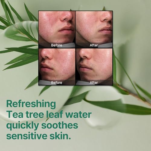 Some By Mi AHA BHA PHA 30 Days Miracle Cream | 60ml | Made From Tea Tree Leaf Water For Sensitive Skin | Mild Moisturizer For Skin Calming & Soothing