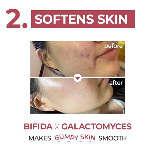 numbuzin No.3 Serum | Skin Softening Serum | Pore Care, Textured Skin, Bumpy, Rough Skin, Glass Skin | Bifida, Galactomyces, Niacinamide, Adenosine, Panthenol | 50ml