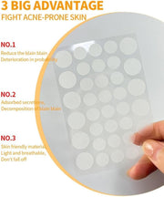 T.M.N. Genuine Acne Pimple Patches – Hydrocolloid, Fast-Healing Spot Stickers for Acne & Blemishes, Vegan-Friendly (36 Count)