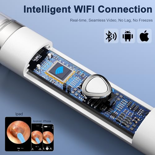 Coolfor Ear Wax Removal Kit，Ear Cleaner with Camera HD 1080P, Ear Wax Removal Tool Camera, Ear Scope Otoscope with 6 LED Lights,Earwax Removal Kit with 5 Ear Spoon for iOS & Android (White)