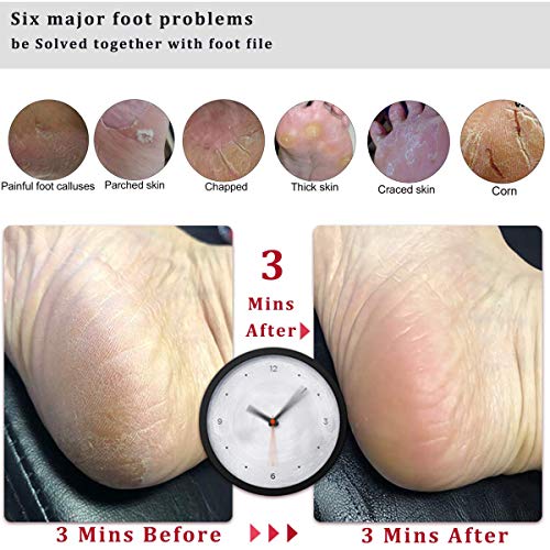 Kinepi LEKESI Professional Foot File Foot Scrubber Hard Skin Callus Remover Pedicure Foot Rasp,Can Be use on Cracked Heels,Dead Skin,Corn,Pumice Stone for Feet Massager Scraper File Brush Tools