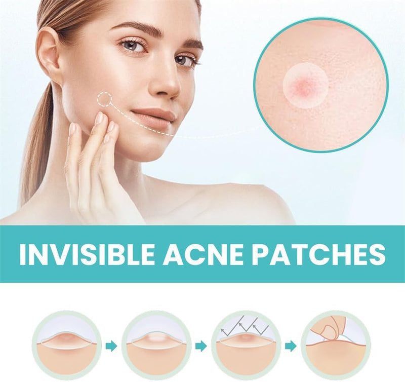 TERRIFI Pimple Patches for Face, 300 Hydrocolloid Patches, Effectively Cover and Repair Acne and Blemishes, Promote Skin Regeneration, Ideal for Makeup and Skincare