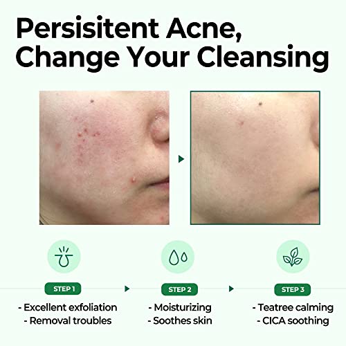 Some By Mi AHA-BHA-PHA 30Days Miracle Cleansing Bar | 106g | For Skin Exfoliating | Pore & Sebum Care | Improves Skin Tone and Inflammation