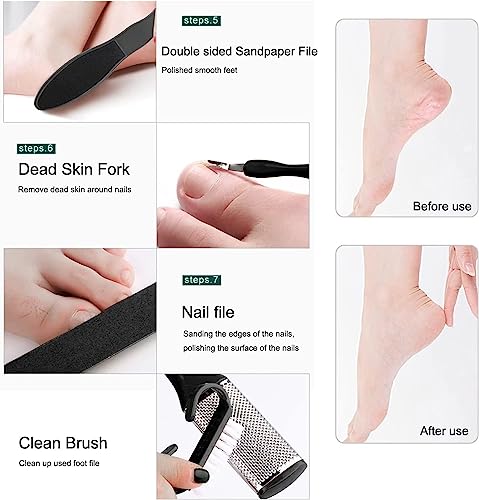 Nnewvante Professional Pedicure Tools Set, 10 in 1 Stainless Steel Foot Care Kit Foot Rasp Dead Skin Remover Pedicure Kit,Foot File Kit Foot Callus Remover, for Men Women Travel