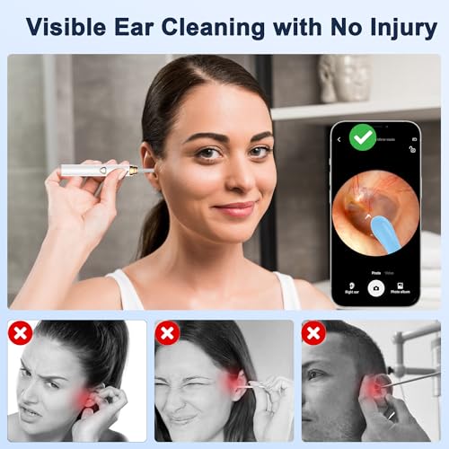 Coolfor Ear Wax Removal Kit，Ear Cleaner with Camera HD 1080P, Ear Wax Removal Tool Camera, Ear Scope Otoscope with 6 LED Lights,Earwax Removal Kit with 5 Ear Spoon for iOS & Android (White)