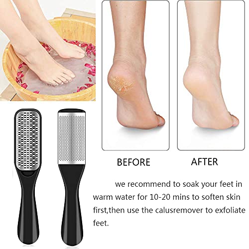 EKOCSIO 36 in 1 Pedicure Kit, Professional Pedicure Tools Foot Rasp Foot Dead Skin Remover for Home & Salon Care
