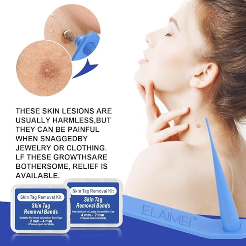 ALMEKAQUZ Home Wart Removal Tool Set for Face and Body,Professional blackhead and acne tool for women and men, Quick and painless blemish cleansing with easy to grip handles, Skincare accessory tha