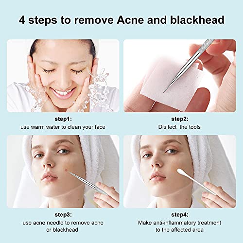 La Chat Blackhead Remover, 2 PCS Pimple Popper ,Stainless Steel Pimple Extractor Blackhead Removal Tool Risk Free Treatment for Blemish,Whitehead Popping