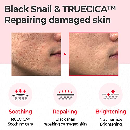 Some By Mi Snail Truecica Miracle Repair Face Toner | 135ml | Made From Snail Mucin For Sensitive Skin | Daily Repair Toner For Skin Texture & Pigmentation Care