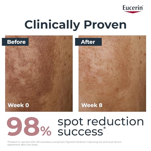 Eucerin Even Pigment Perfector Dual Face Serum Cream, Reduces Pigment Spots, Plumps up Wrinkles, Refines Skin Texture, Suitable for All Skin Types, 30ml