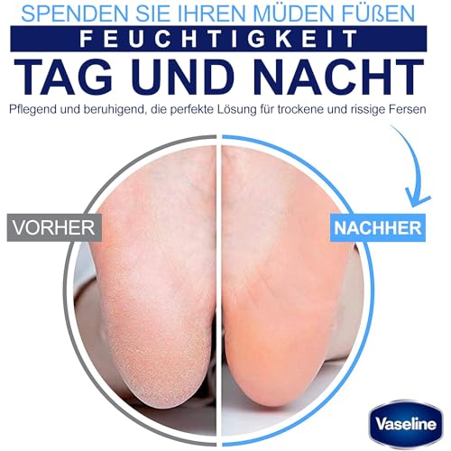 Vaseline Foot Cream Deep Moisture, 55gm