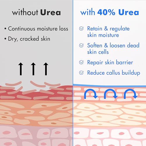 Ebanel Urea Cream 40% plus Salicylic Acid 2%, Foot Cream for Dry Cracked Feet Heels Knees Elbows Hands Repair Treatment, Foot Moisturizer Corn Callus Dead Skin Remover Toenail Softener for Feet Care